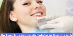 Ile kosztują implanty zębów w Niemczech